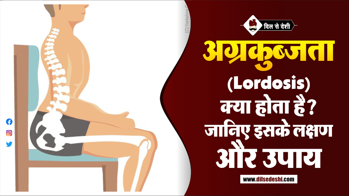 What Is The Meaning Of Lordosis In Hindi